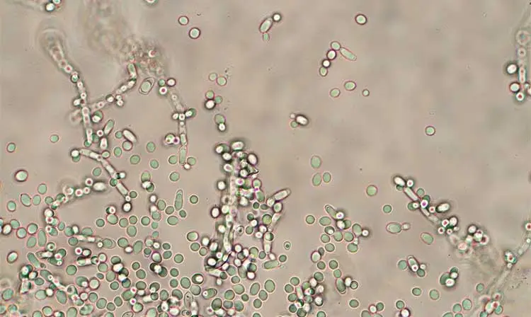 Yeast